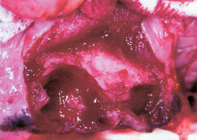 L400xH284jpg_image2dentpetite-25c35.jpg