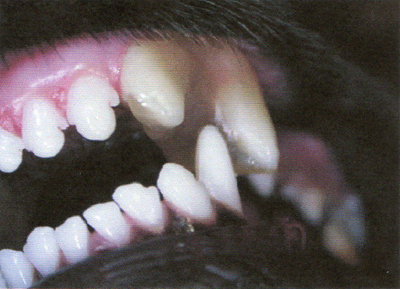 L400xH289jpg_image6dentpetite-d0a3b.jpg
