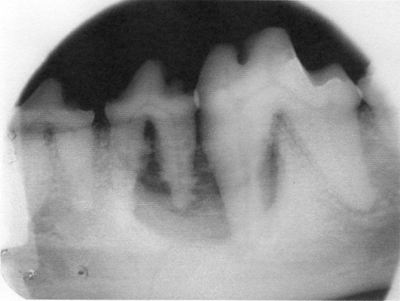 L400xH301jpg_image1dentpetite-7605b.jpg