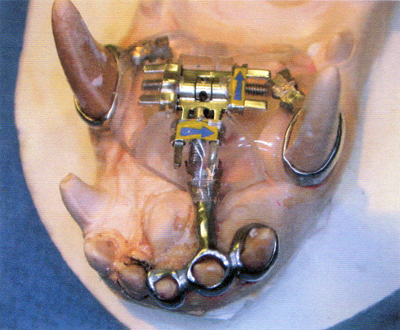 L400xH330jpg_image8dentpetite-b82a2.jpg