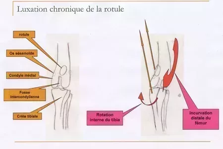L450xH302_rotule_bruno_1-ad5fb-2.jpg