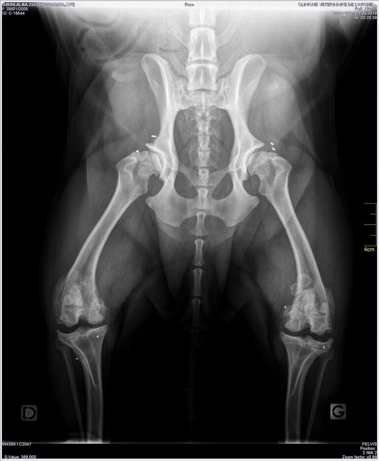 radio_cn_implants.jpg