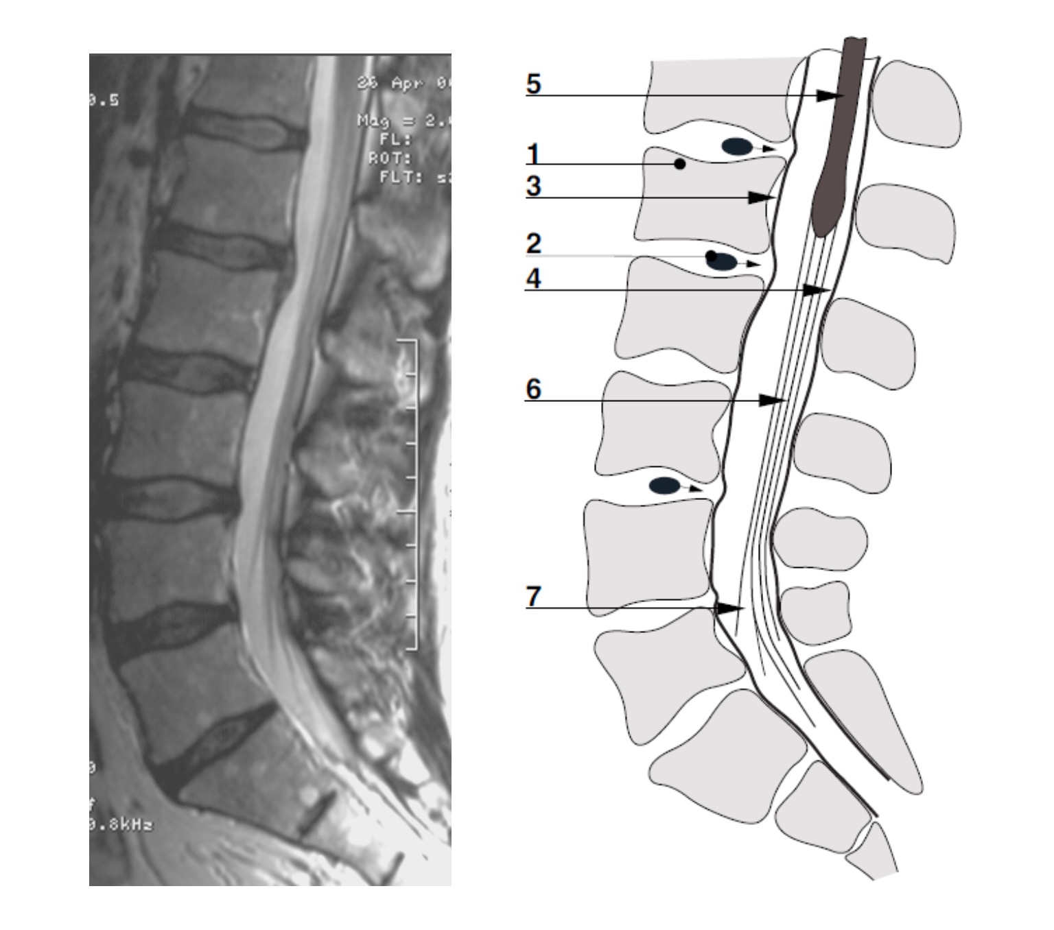 fig_4_irm.jpg