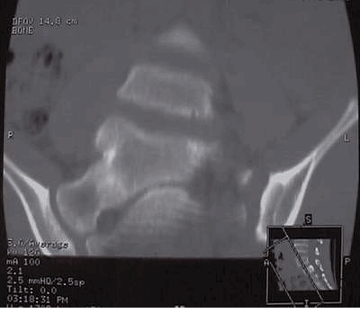 Scanner avec acquisition hélicoïdale