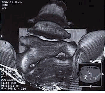 Scanner avec reconstruction en 3 D