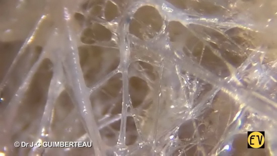Fascia - Dr J-C Guimberteau