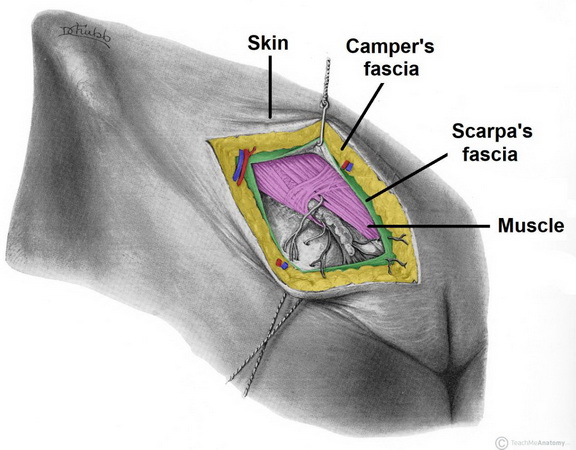 layers-of-the-anterolateral-abdominal-wall-fascia-muscle-1024x800.jpg