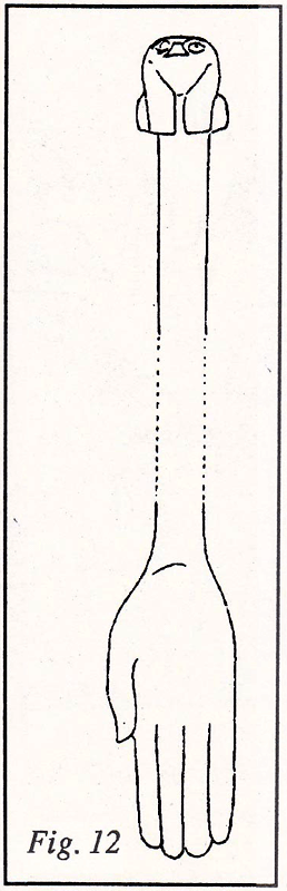 osteo_15_fig12.gif