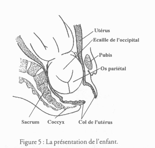 revue_es41-tricot-fig05.jpg