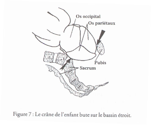 revue_es41-tricot-fig07.jpg