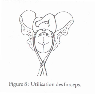 revue_es41-tricot-fig08.jpg