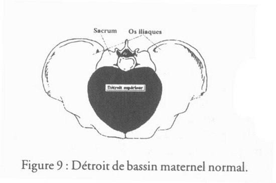 revue_es41-tricot-fig09.jpg