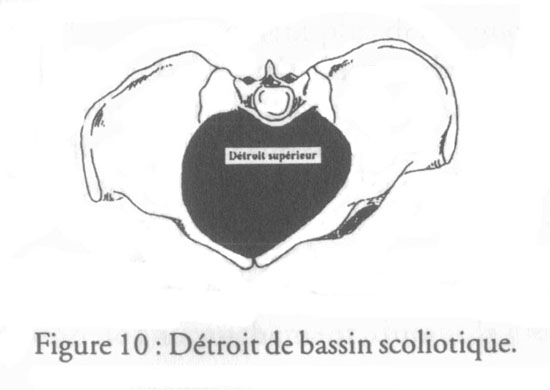 revue_es41-tricot-fig10.jpg