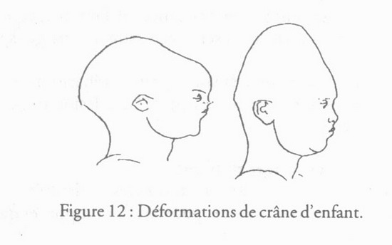revue_es41-tricot-fig12.jpg
