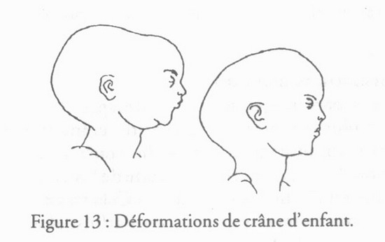 revue_es41-tricot-fig13.jpg