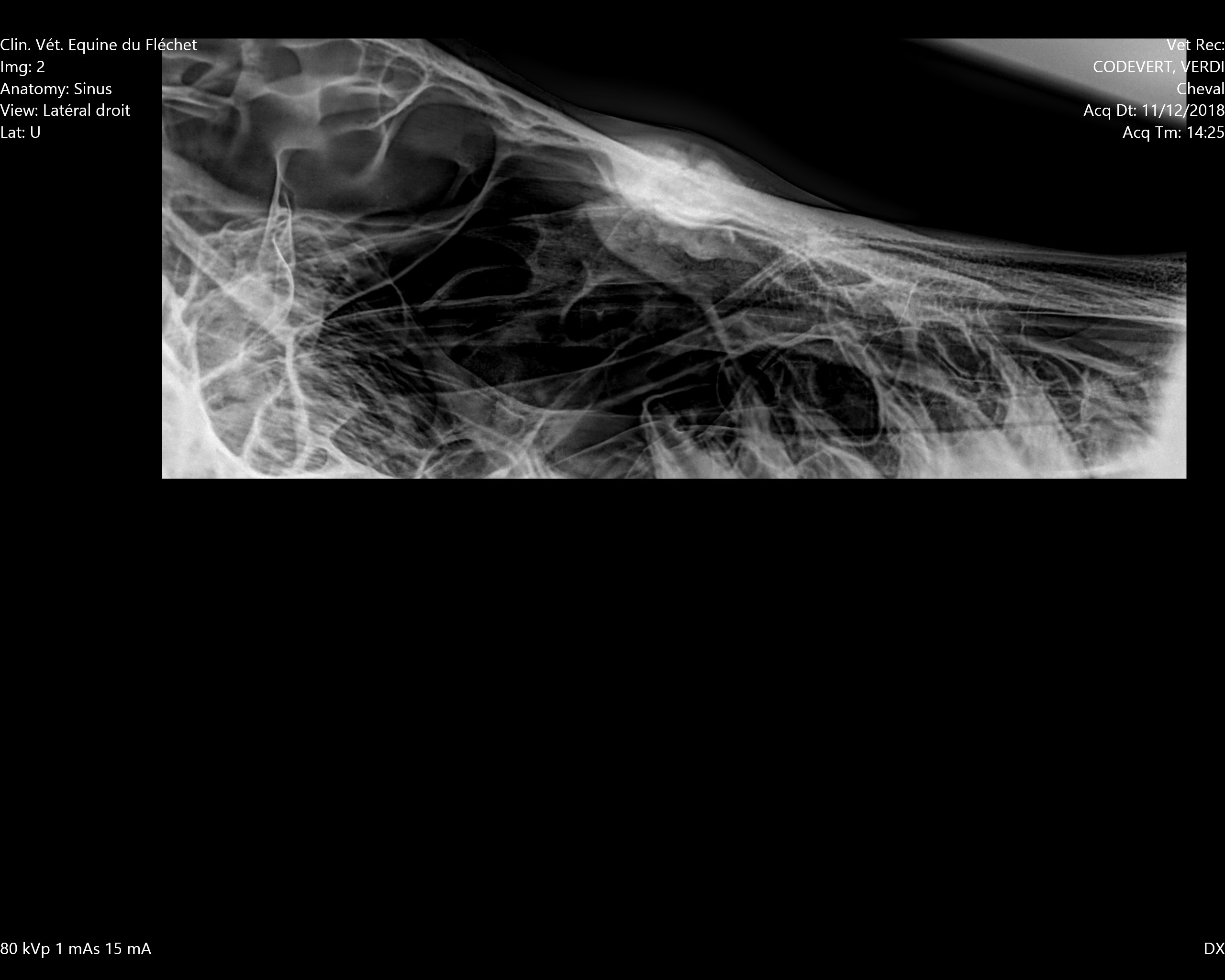 1_verdi_sinus_lateral_droit.jpg