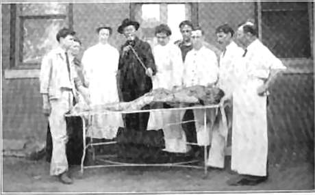aso-disection.jpg